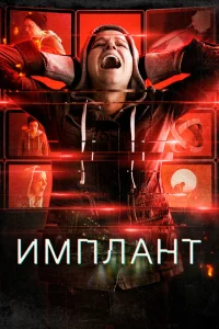 Имплант Имплант